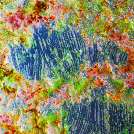 Bifunctional fluorescent probes for detection of amyloid aggregates and reactive oxygen species